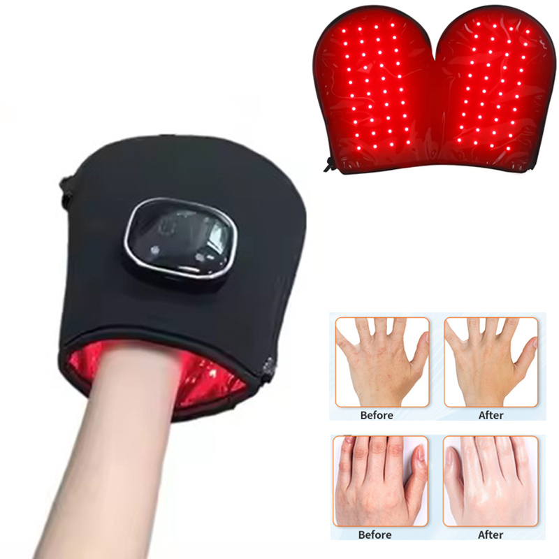 Nieuw Rood Lichttherapie Appar - Galvanic Skin Sensor recensie en prijs
